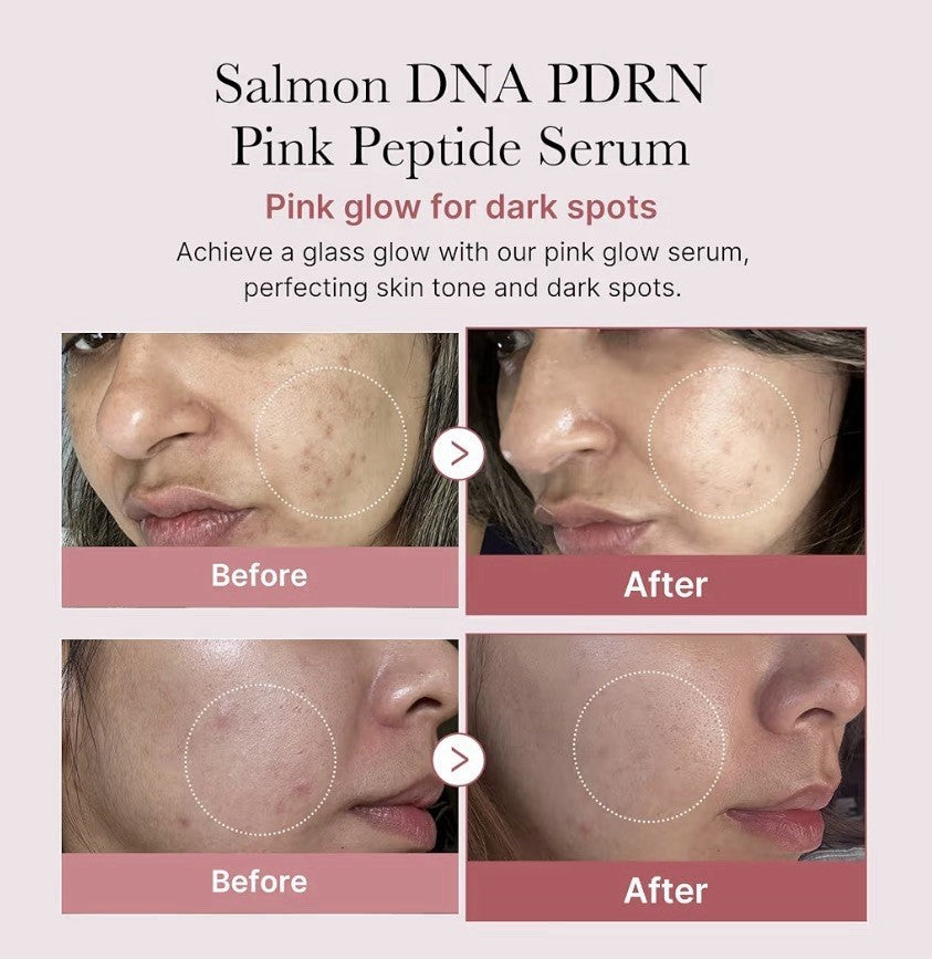 Medicube PDRN Pink Peptide Serum 1.01 Fl Oz– SALMON DNA | Anti-Aging Care