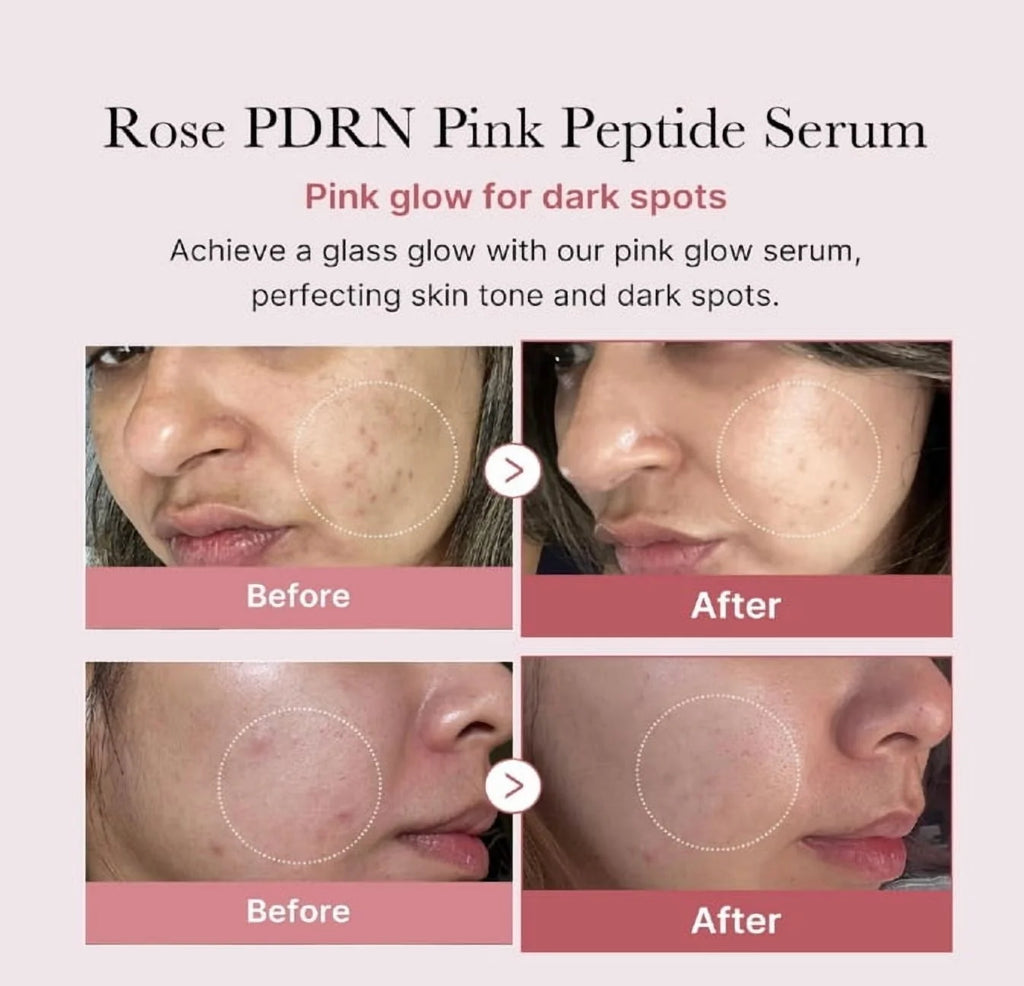 - PDRN Pink Peptide Serum (30Ml)